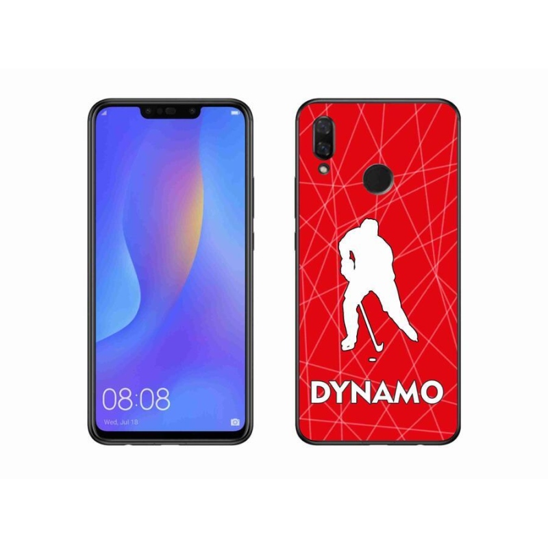 Gél borítás mmCase a Huawei Nova 3 - Dynamo 2 készülékhez