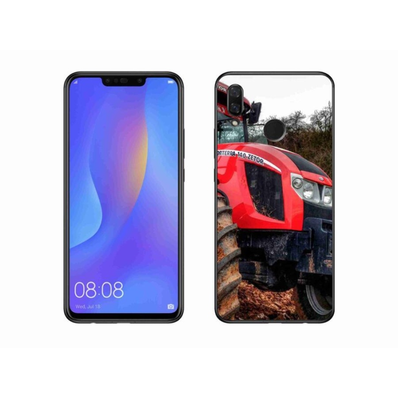 Gél borítás mmCase a Huawei Nova 3 készülékhez - zetor