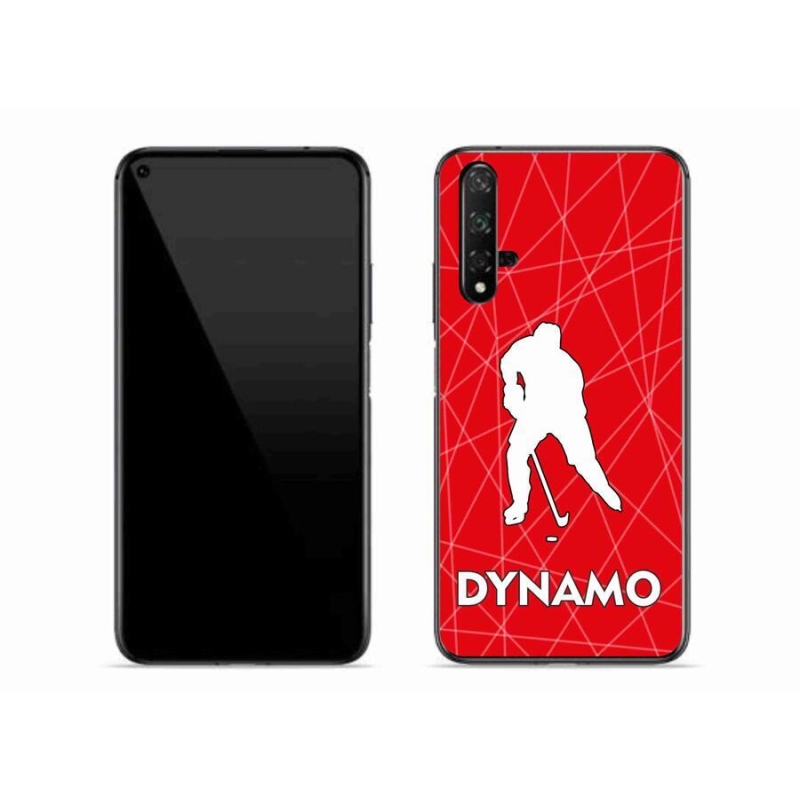 Gél borítás mmCase a Huawei Nova 5T-hez - Dynamo 2