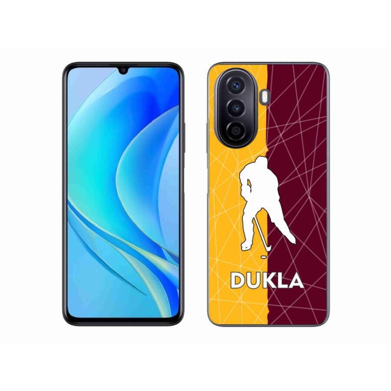 Gél védőhuzat mmCase mobil Huawei Nova Y70 - Dukla