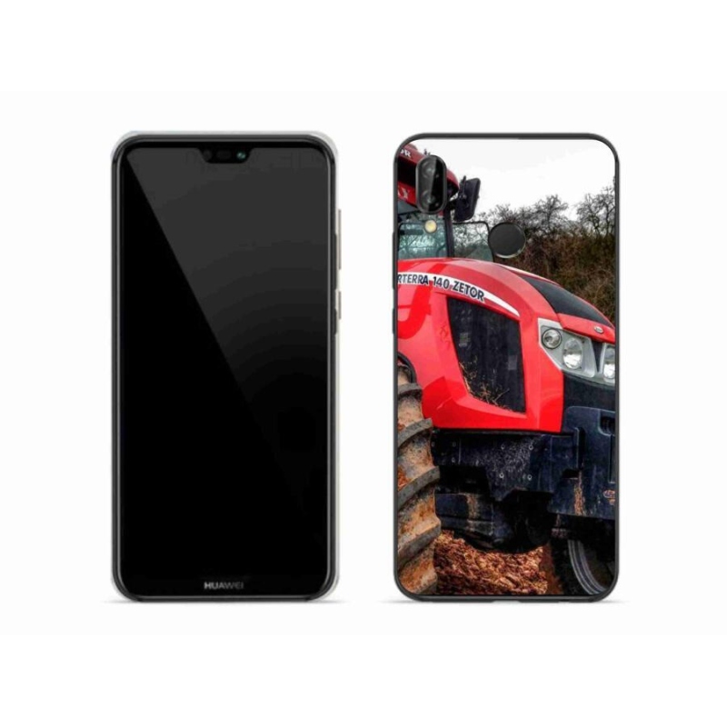 Gél borítás mmCase a Huawei P20 Lite készülékhez - zetor