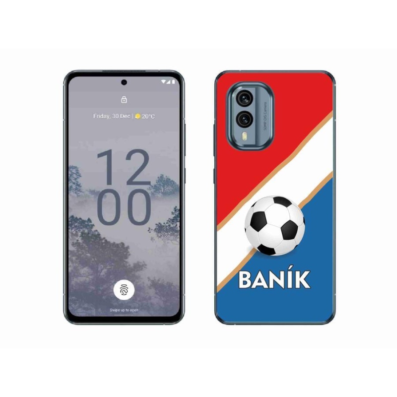 Zselés borítás mmCase a Nokia X30 5G készülékhez - Baník
