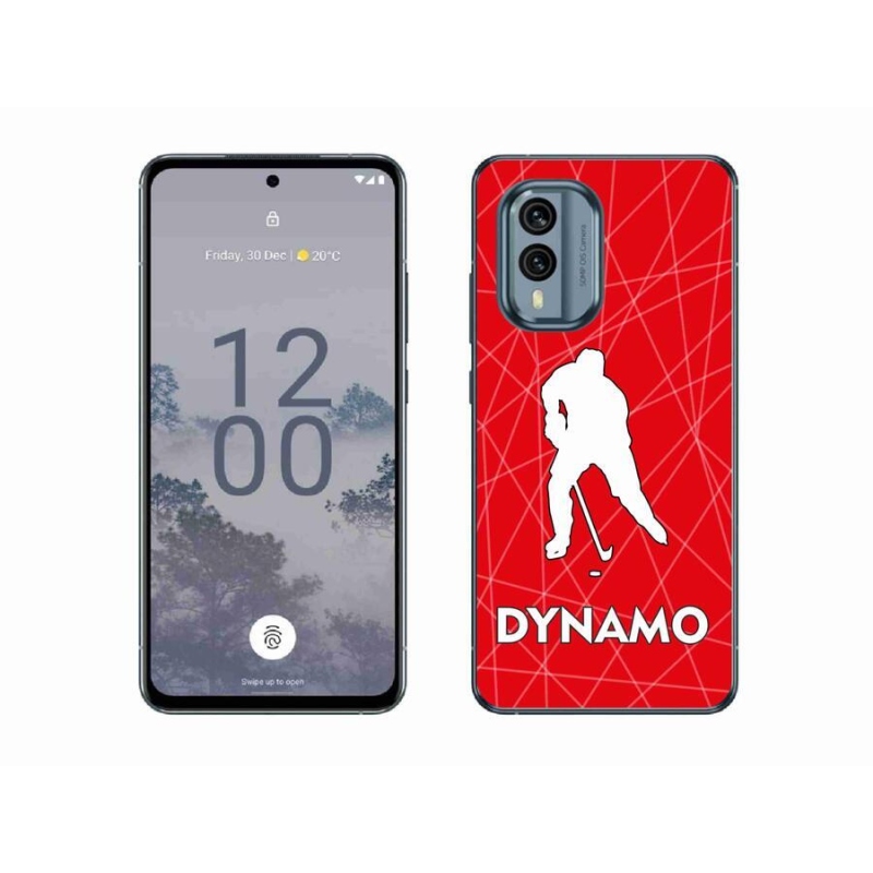 Zselés borítás mmCase a Nokia X30 5G készülékhez - Dynamo 2
