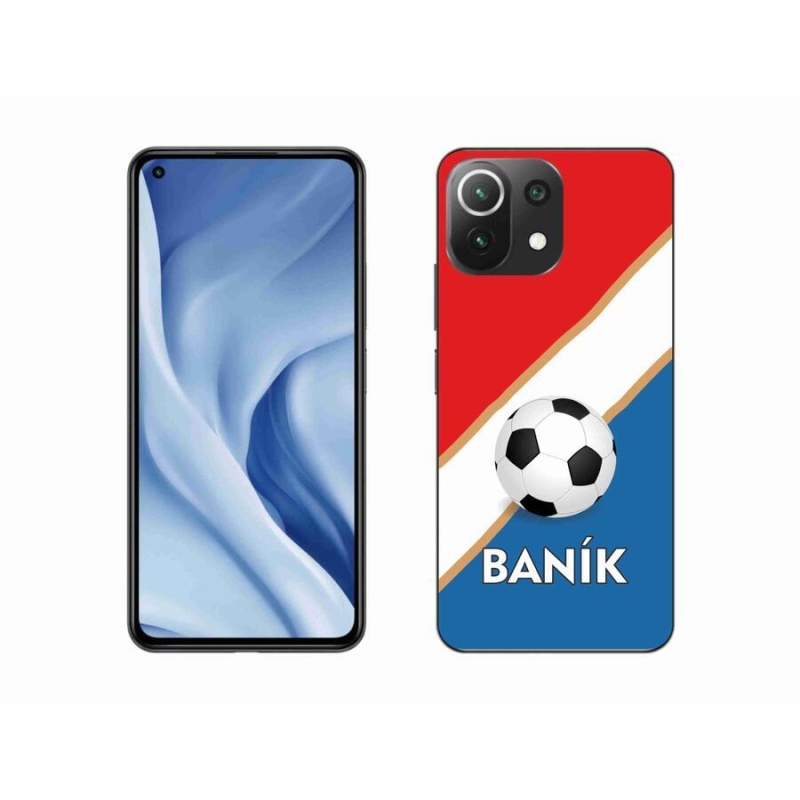 Zselés borítás mmCase a Xiaomi 11 Lite 5G NE számára - Baník