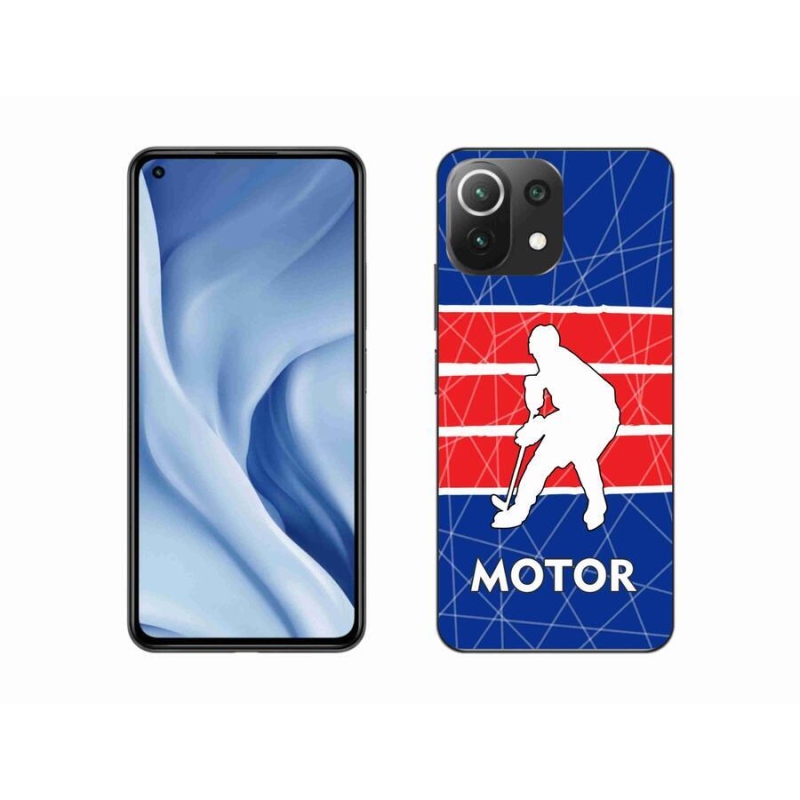 Gél borítás mmCase a Xiaomi 11 Lite 5G NE számára - Motor