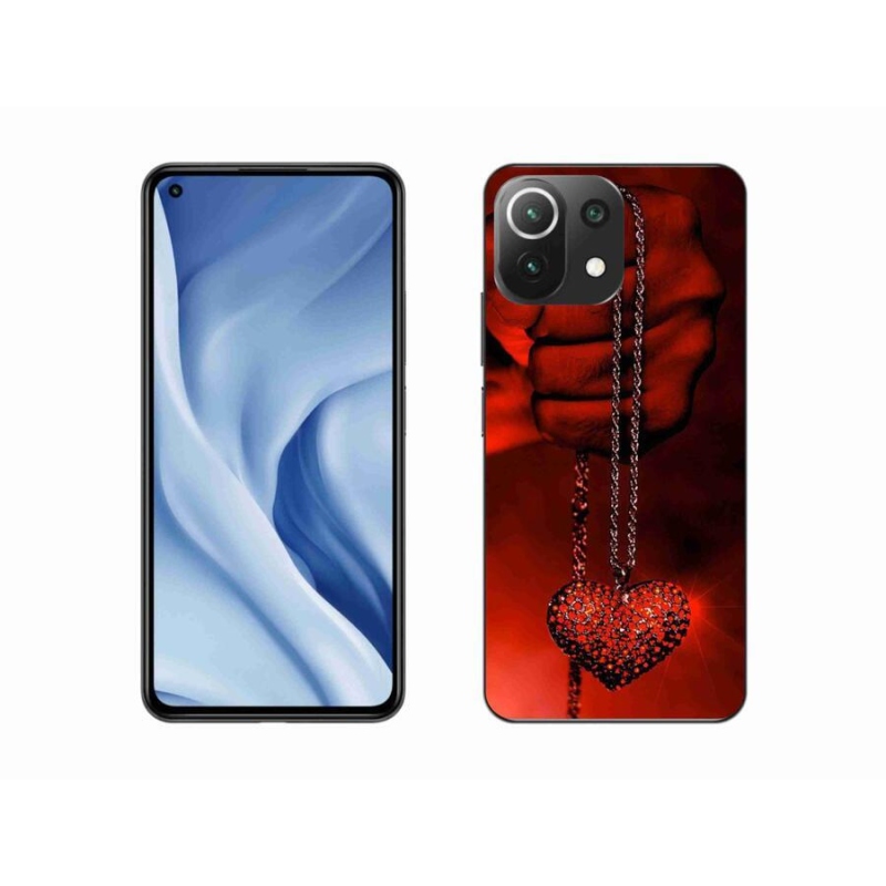 Gélburkolat mmCase a Xiaomi 11 Lite 5G NE - nyaklánchoz