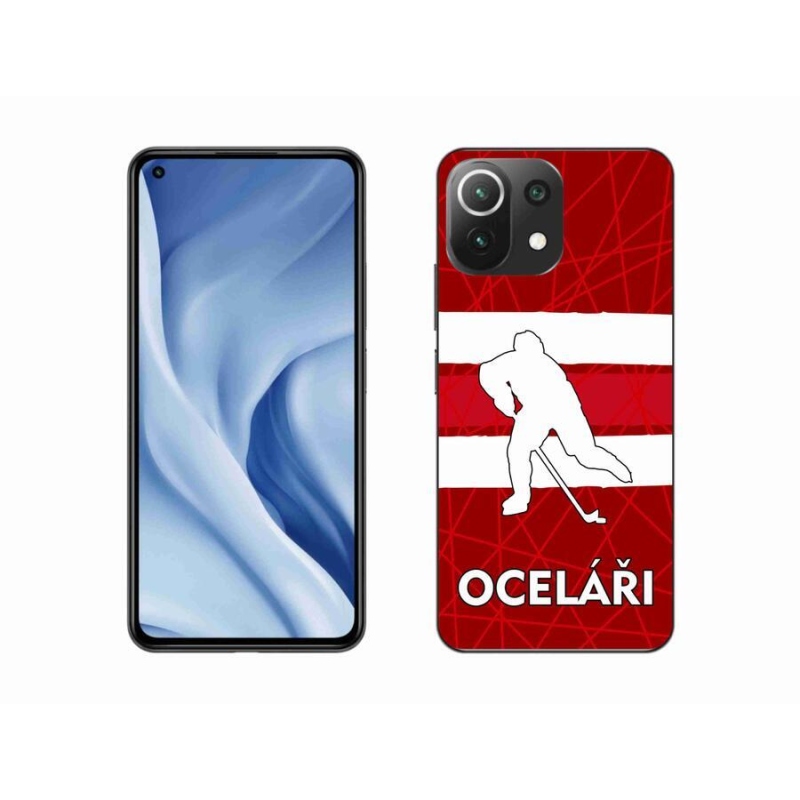 Gél borítás mmCase a Xiaomi 11 Lite 5G NE számára - Acélsárgák