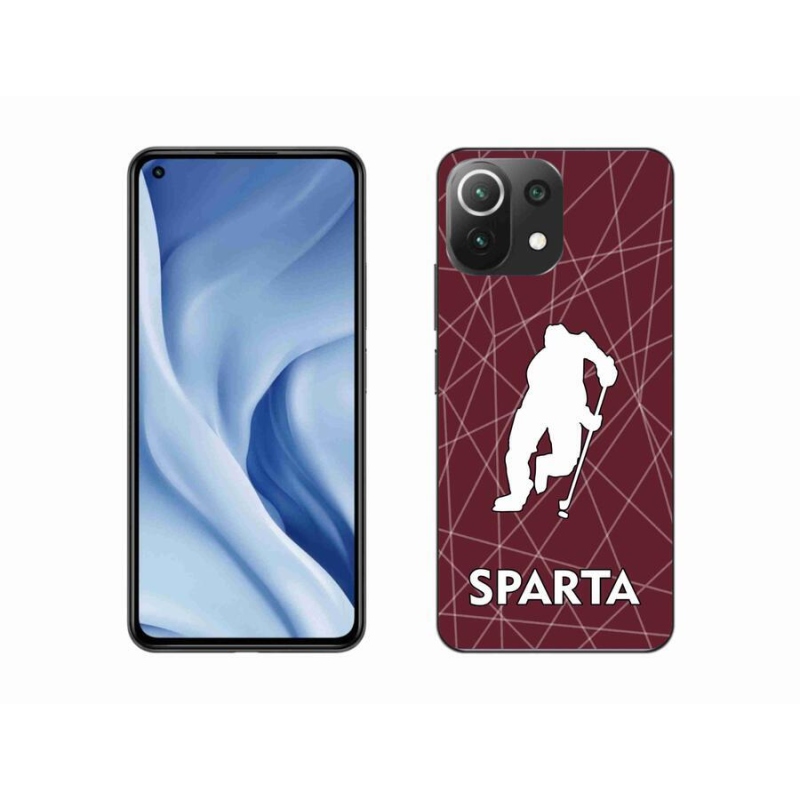 Gél borítás mmCase a Xiaomi 11 Lite 5G NE számára - Sparta