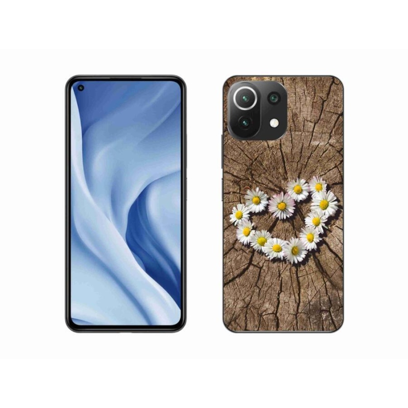Gélburkolat mmCase a Xiaomi 11 Lite 5G NE számára - százszorszépek szíve