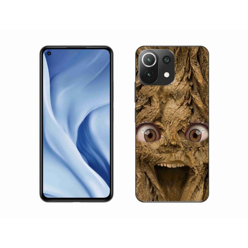 Gélburkolat mmCase a Xiaomi 11 Lite 5G NE számára - vidám fa szemekkel