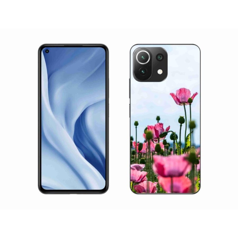 Gél borítás mmCase a Xiaomi 11 Lite 5G NE számára - mákos színű