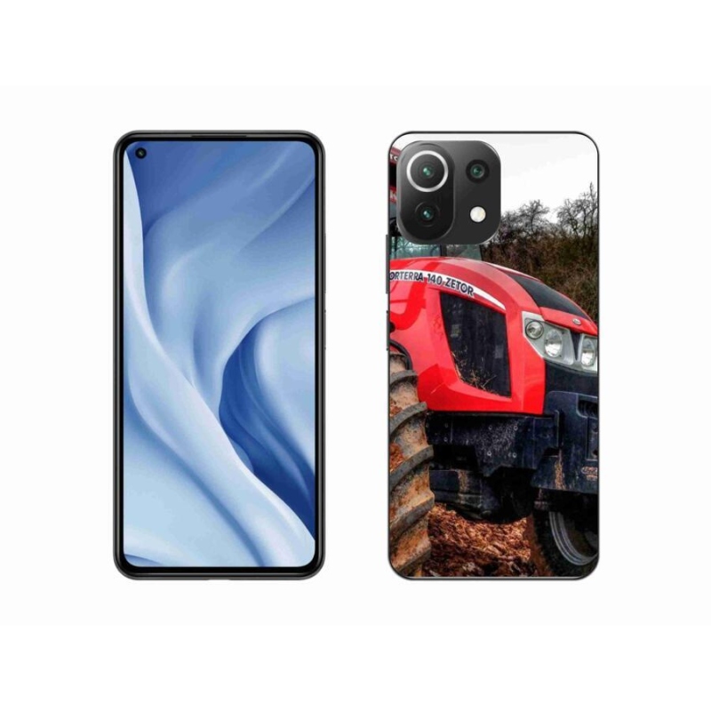 Gél borítás mmCase a Xiaomi 11 Lite 5G NE számára - zetor