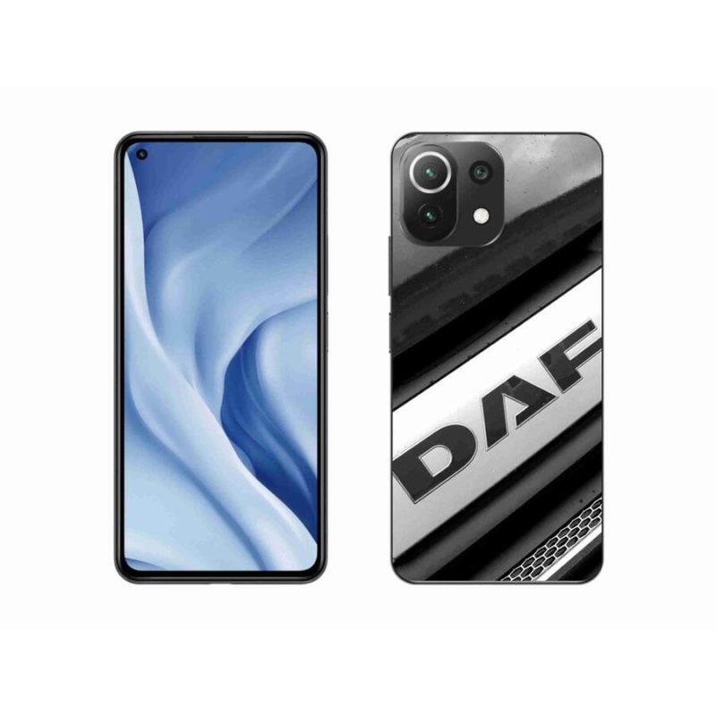 Gélburkolat mmCase a Xiaomi 11 Lite 5G NE számára - karakter 4