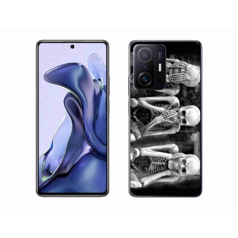 Gél borítás mmCase a Xiaomi 11T Pro számára - csontvázak