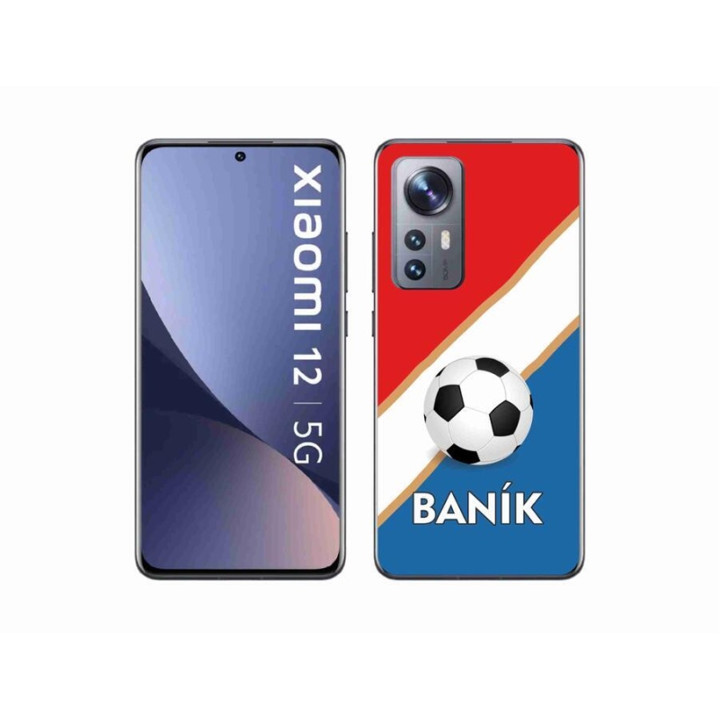 Gél borítás mmCase a Xiaomi 12-hez - Baník