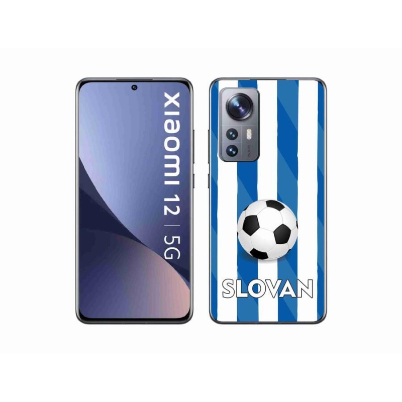 Gél borítás mmCase a Xiaomi 12X készülékhez - Slovan