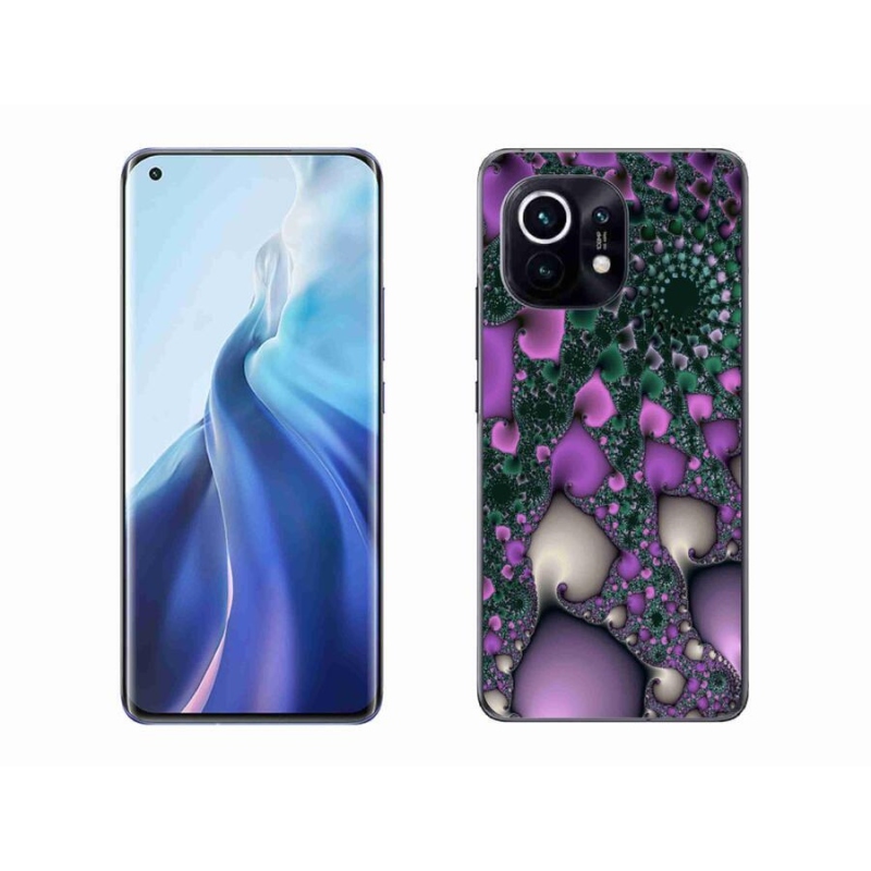 Gél borítás mmCase a Xiaomi Mi 11 - kivonat 7