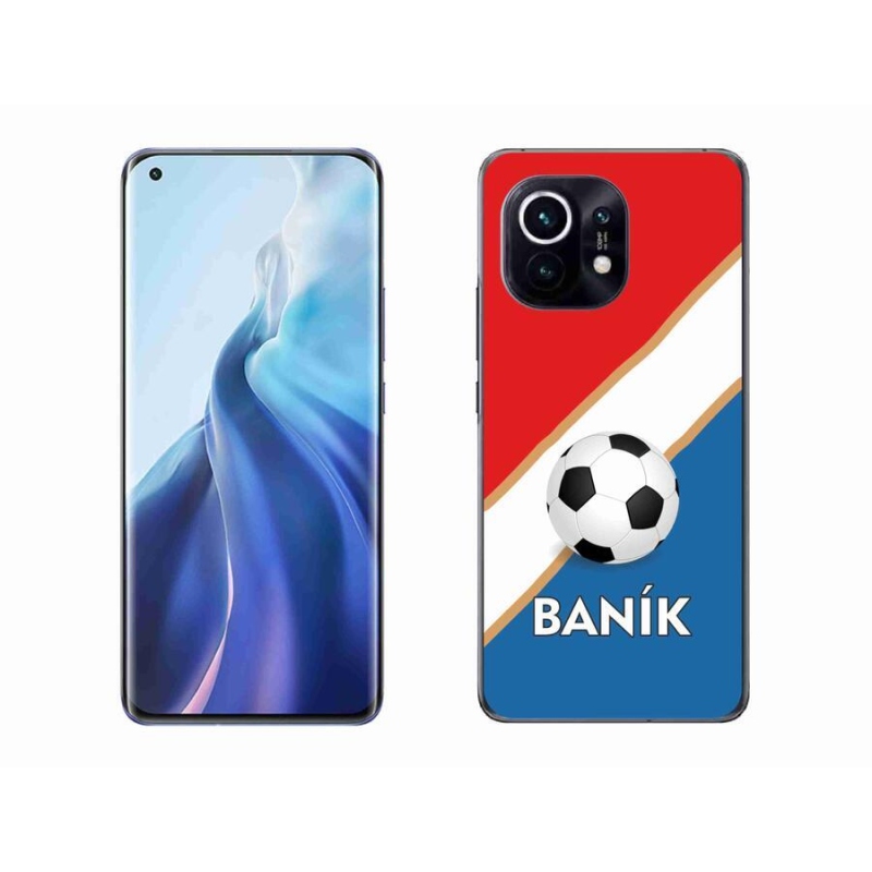 Gél borítás mmCase a Xiaomi Mi 11-hez - Baník