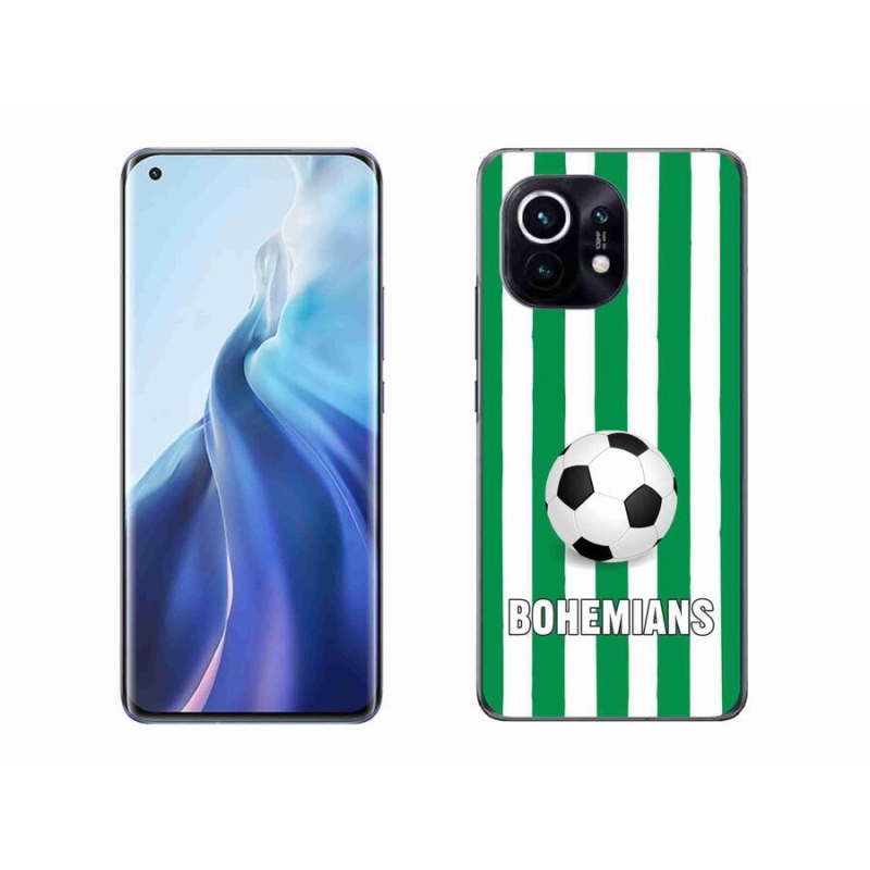 Gél borítás mmCase a Xiaomi Mi 11-hez - Bohemians