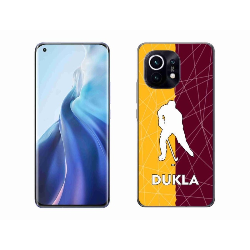 Gél borítás mmCase a Xiaomi Mi 11 készülékhez - Dukla