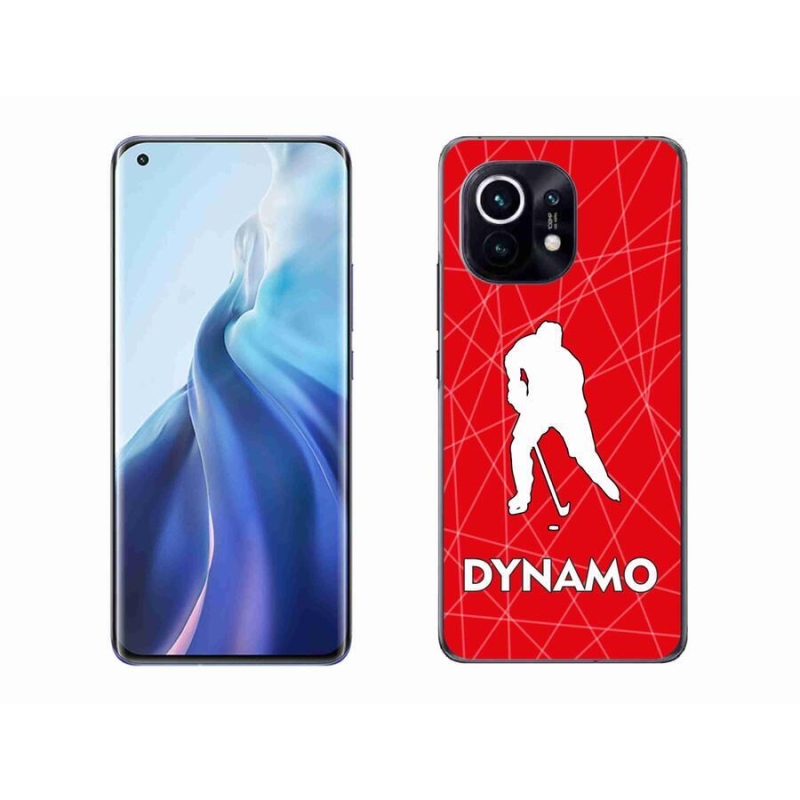 Gél borítás mmCase a Xiaomi Mi 11-hez - Dynamo 2