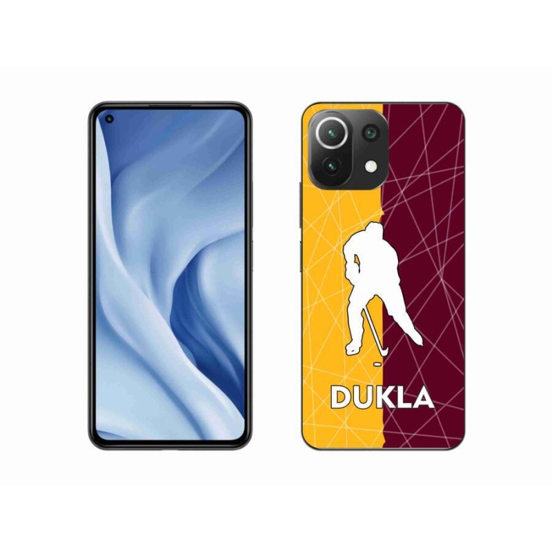 Gél borítás mmCase a Xiaomi Mi 11 Lite 4G/5G készülékhez - Dukla