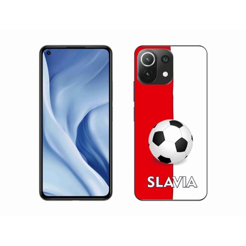Gél borítás mmCase a Xiaomi Mi 11 Lite 4G/5G-hez - futballpálya 2