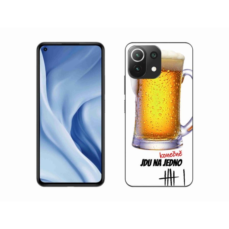 Gélburkolat mmCase a Xiaomi Mi 11 Lite 4G/5G számára - megyek az egyikhez