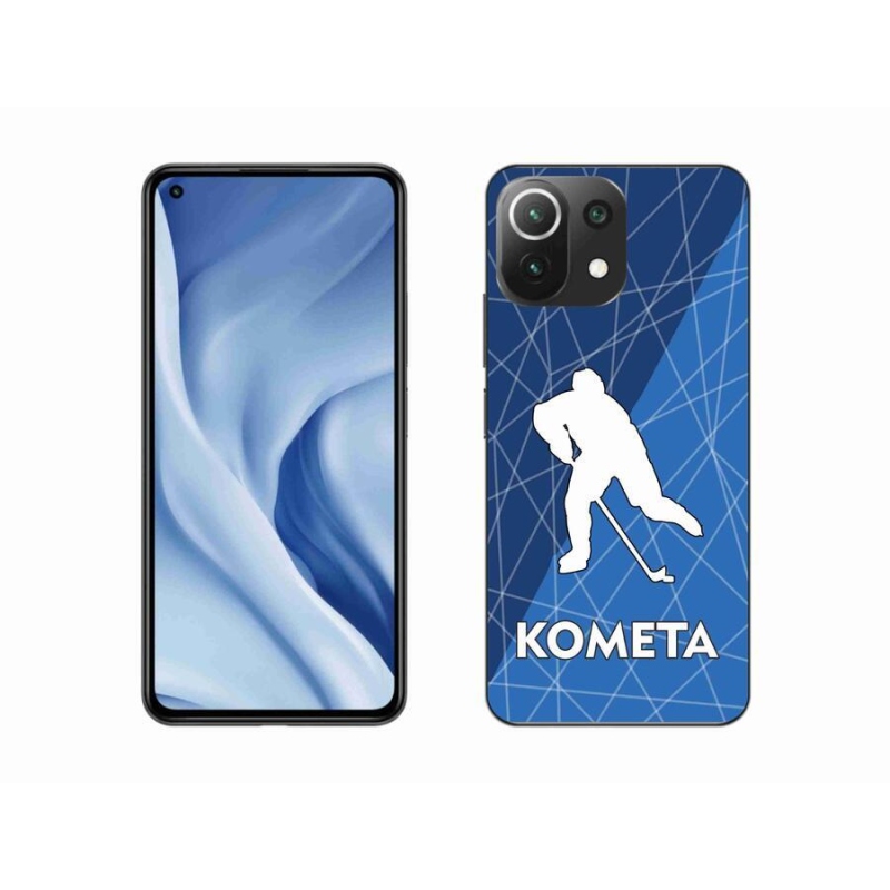 Gél borítás mmCase a Xiaomi Mi 11 Lite 4G/5G készülékhez - Comet