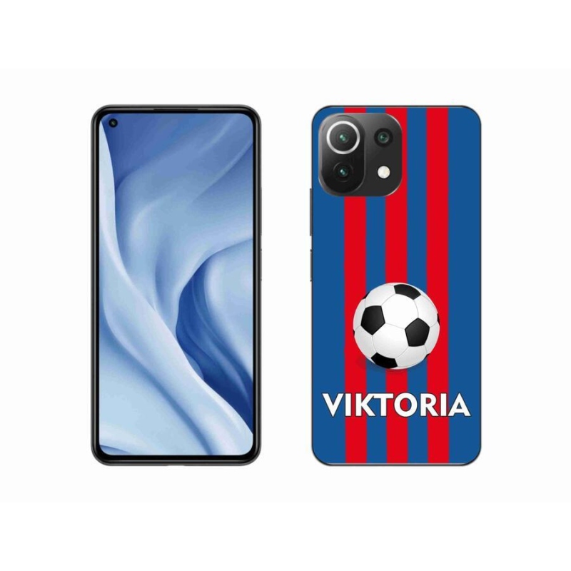 Gél borítás mmCase a Xiaomi Mi 11 Lite 4G/5G készülékhez - Viktoria