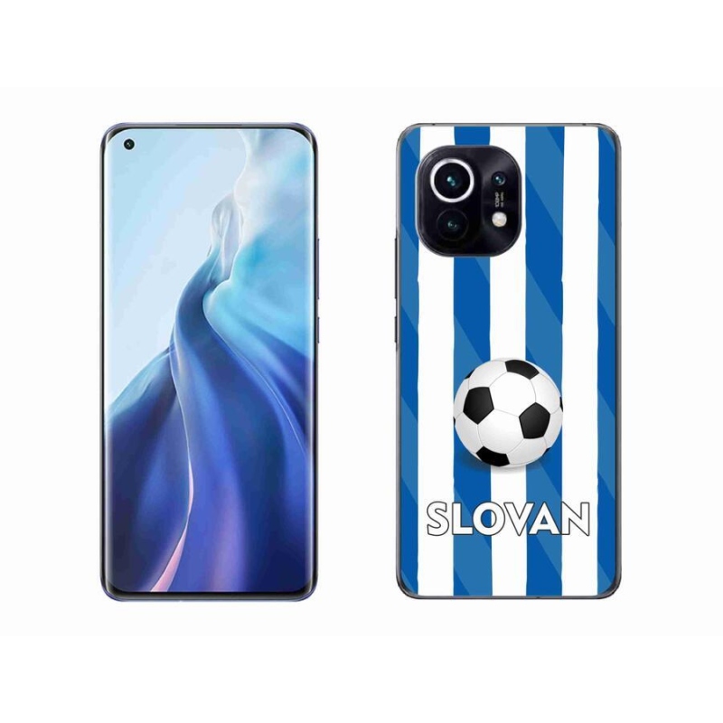 Gél borítás mmCase a Xiaomi Mi 11 készülékhez - Slovan