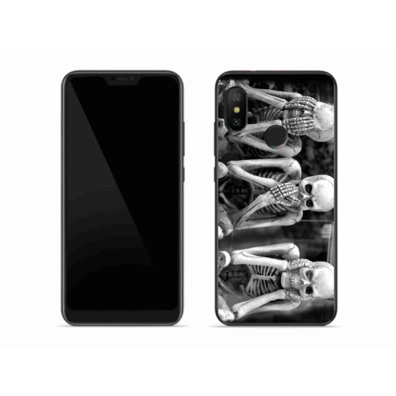 Gél borítás mmCase a Xiaomi Mi A2 Lite készülékhez - csontvázak