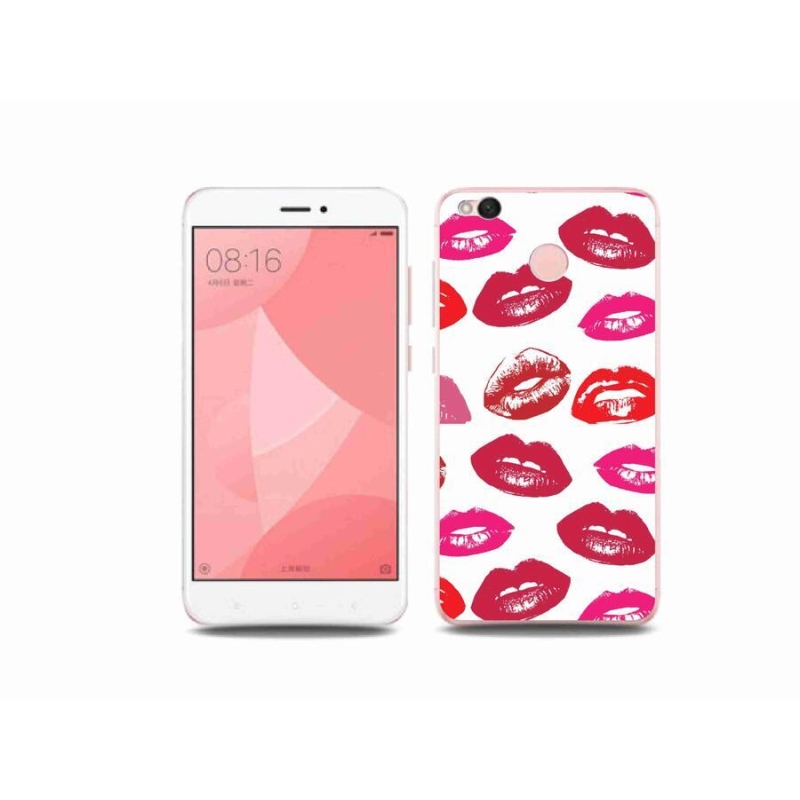 Gél borítás mmCase a Xiaomi Redmi 4X-hez - ajkak