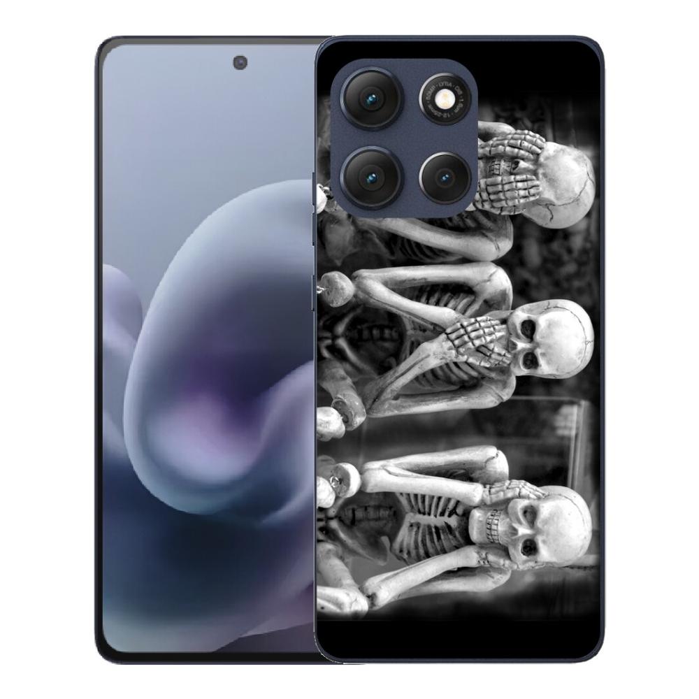 mmCase gél tok a Motorola Moto G86 5G-hez – csontvázak