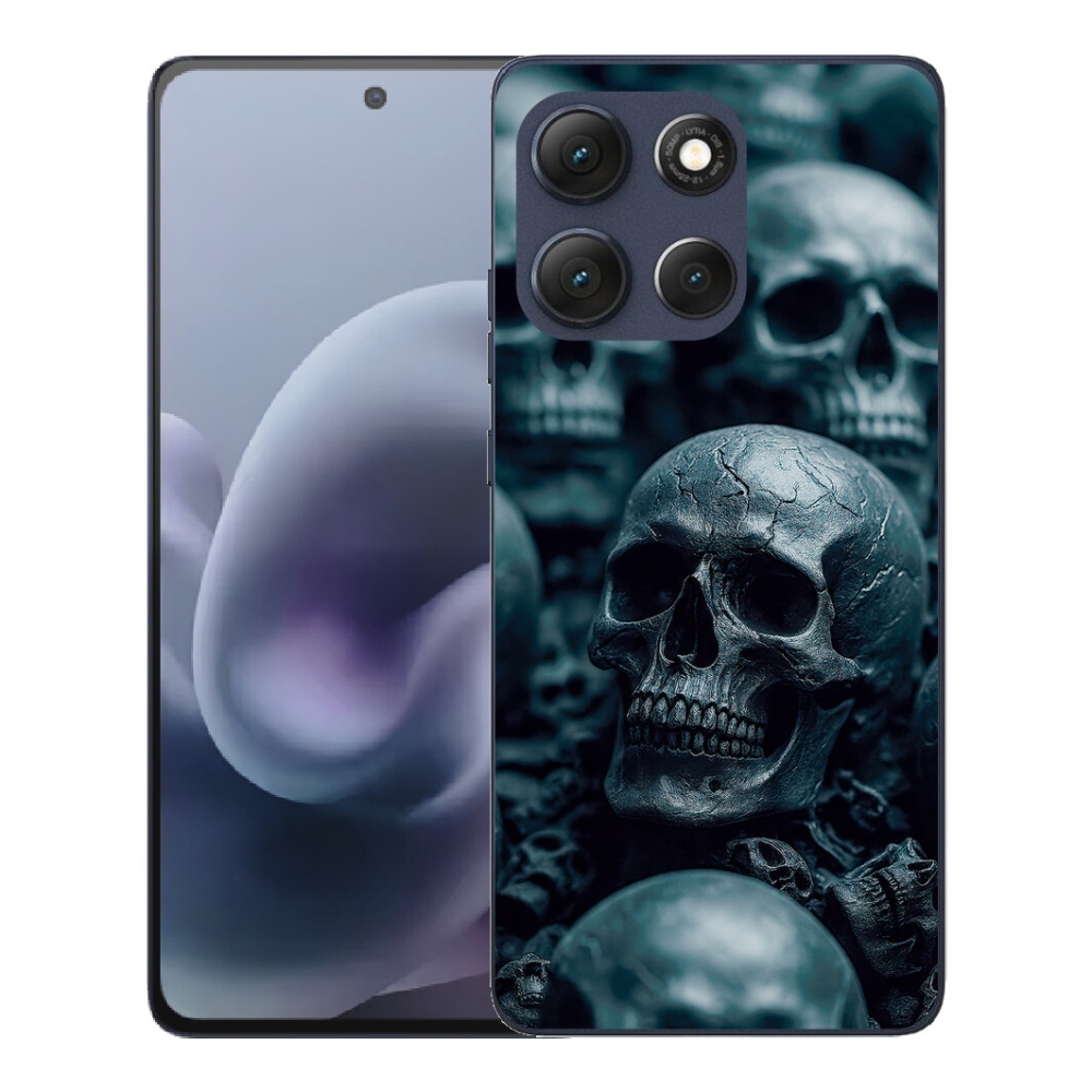 mmCase gél tok a Motorola Moto G86 5G-hez – koponya 2