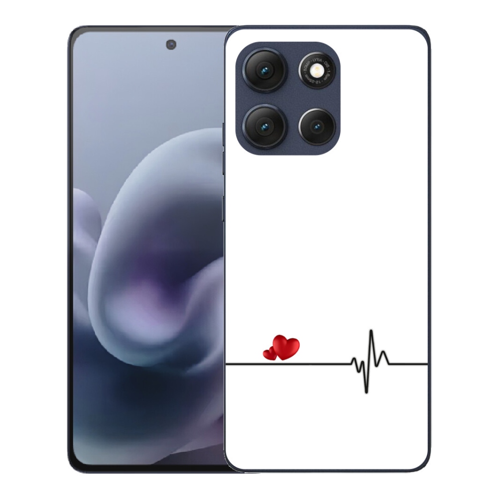 mmCase géltok a Motorola Moto G86 5G-hez – szív és pulzus fehér háttérrel