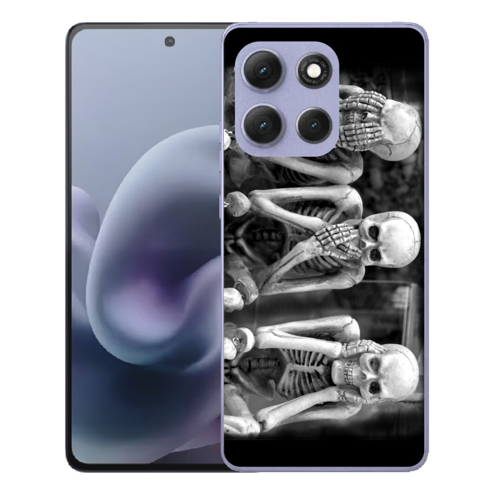 mmCase géltok a Motorola Moto G86 Power 5G-hez – csontvázak