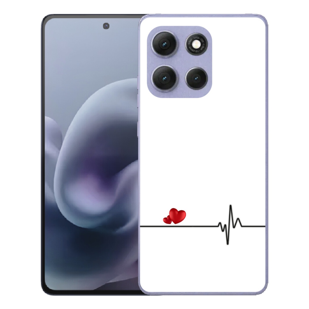 mmCase géltok a Motorola Moto G86 Power 5G-hez – szív és pulzus fehér háttérrel