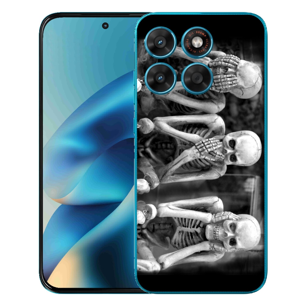 mmCase géltok a Motorola Moto G87/G77/G67 készülékekhez – csontvázak
