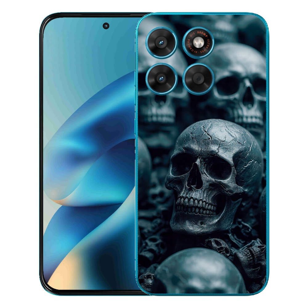 mmCase gél tok a Motorola Moto G87/G77/G67-hez – koponya 2