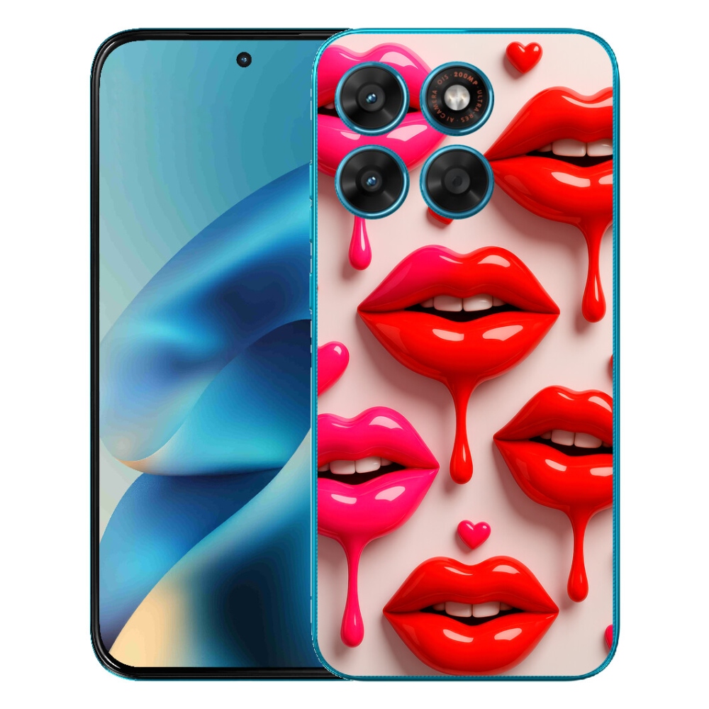 mmCase géltok a Motorola Moto G87/G77/G67 készülékekhez – ajkak 2