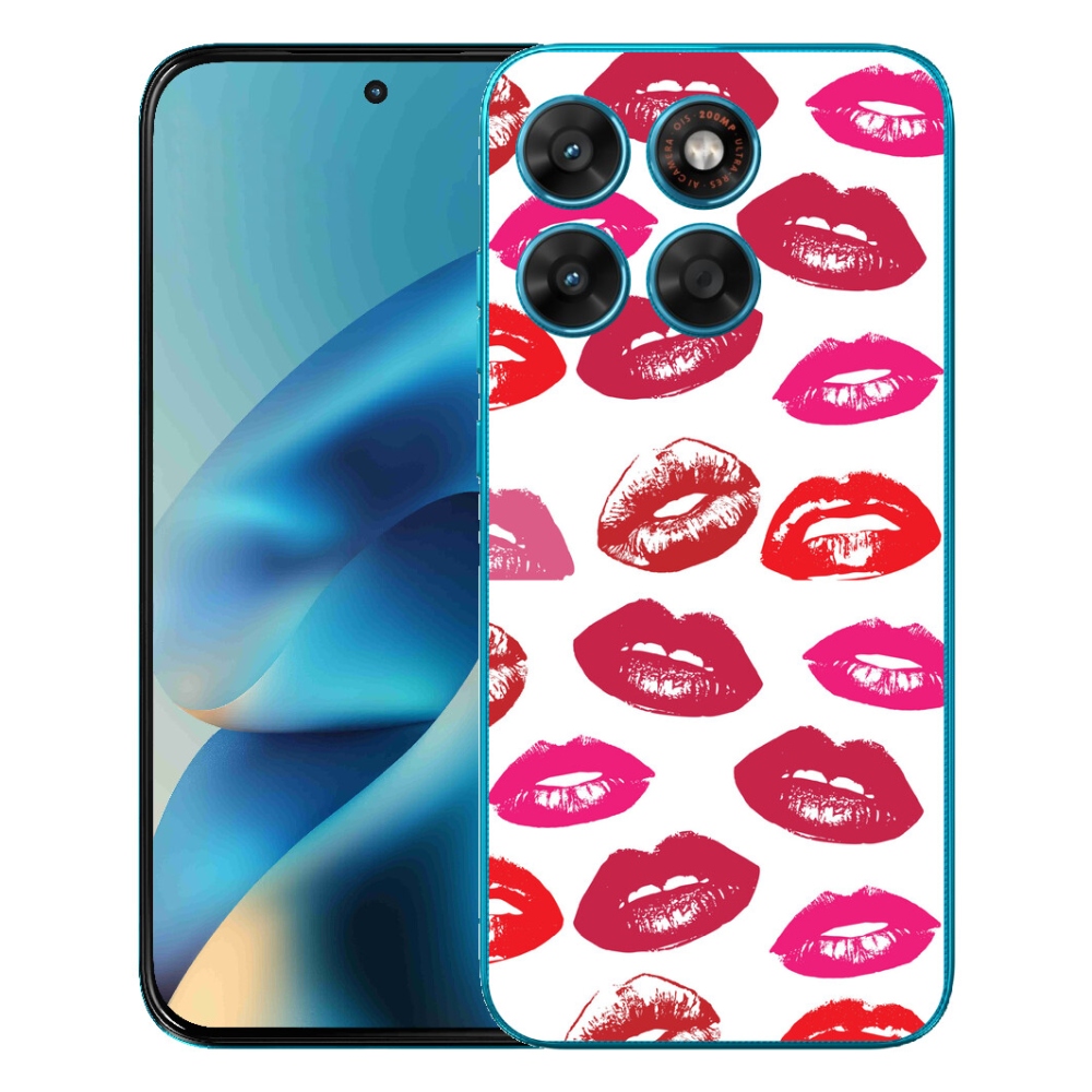 mmCase gél tok a Motorola Moto G87/G77/G67 készülékekhez – ajkak
