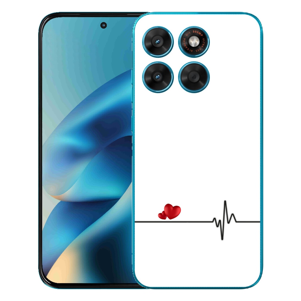 mmCase gélhuzat a Motorola Moto G87/G77/G67-hez – szív és pulzus fehér háttérrel
