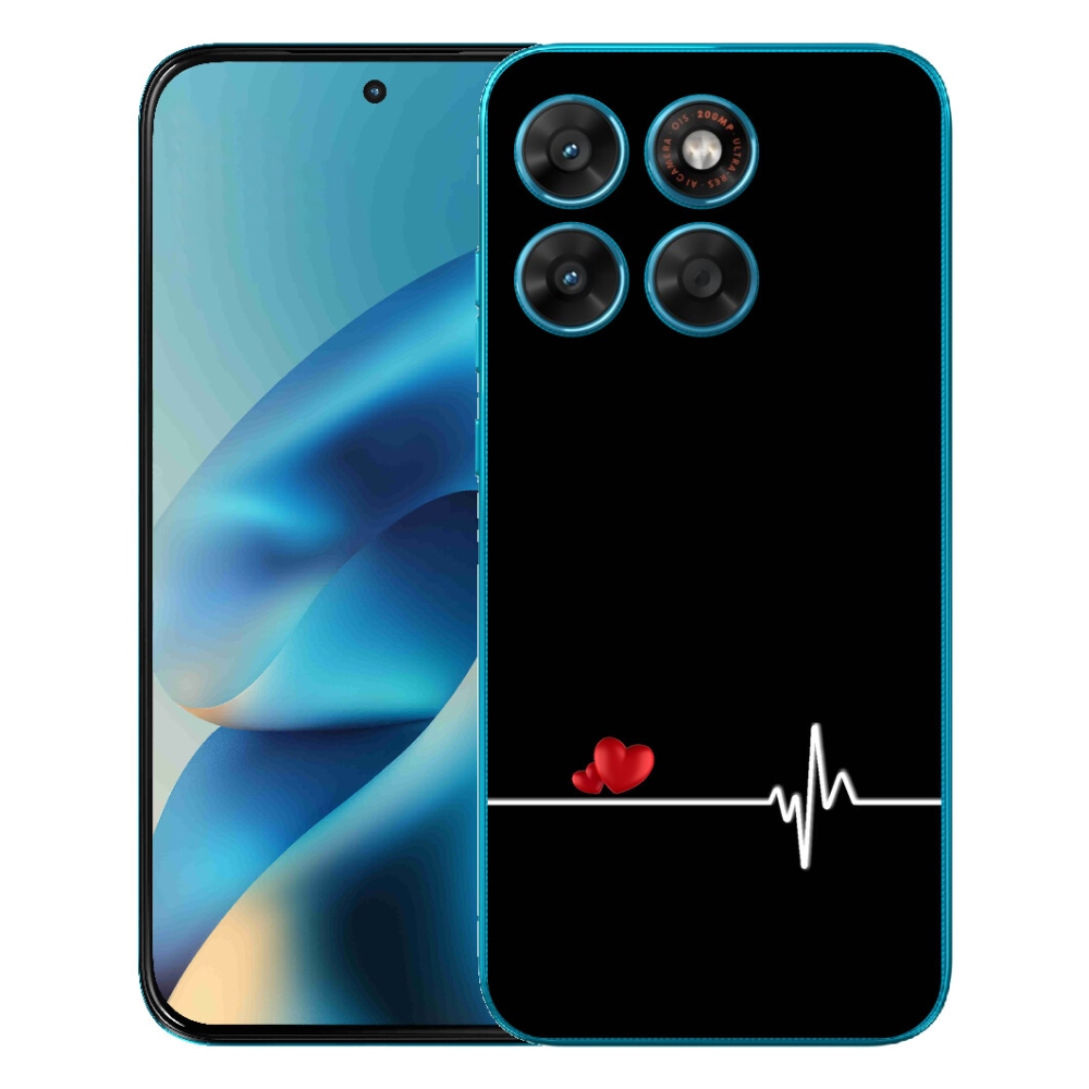 mmCase gél tok a Motorola Moto G87/G77/G67-hez – szív és pulzus fekete háttérrel