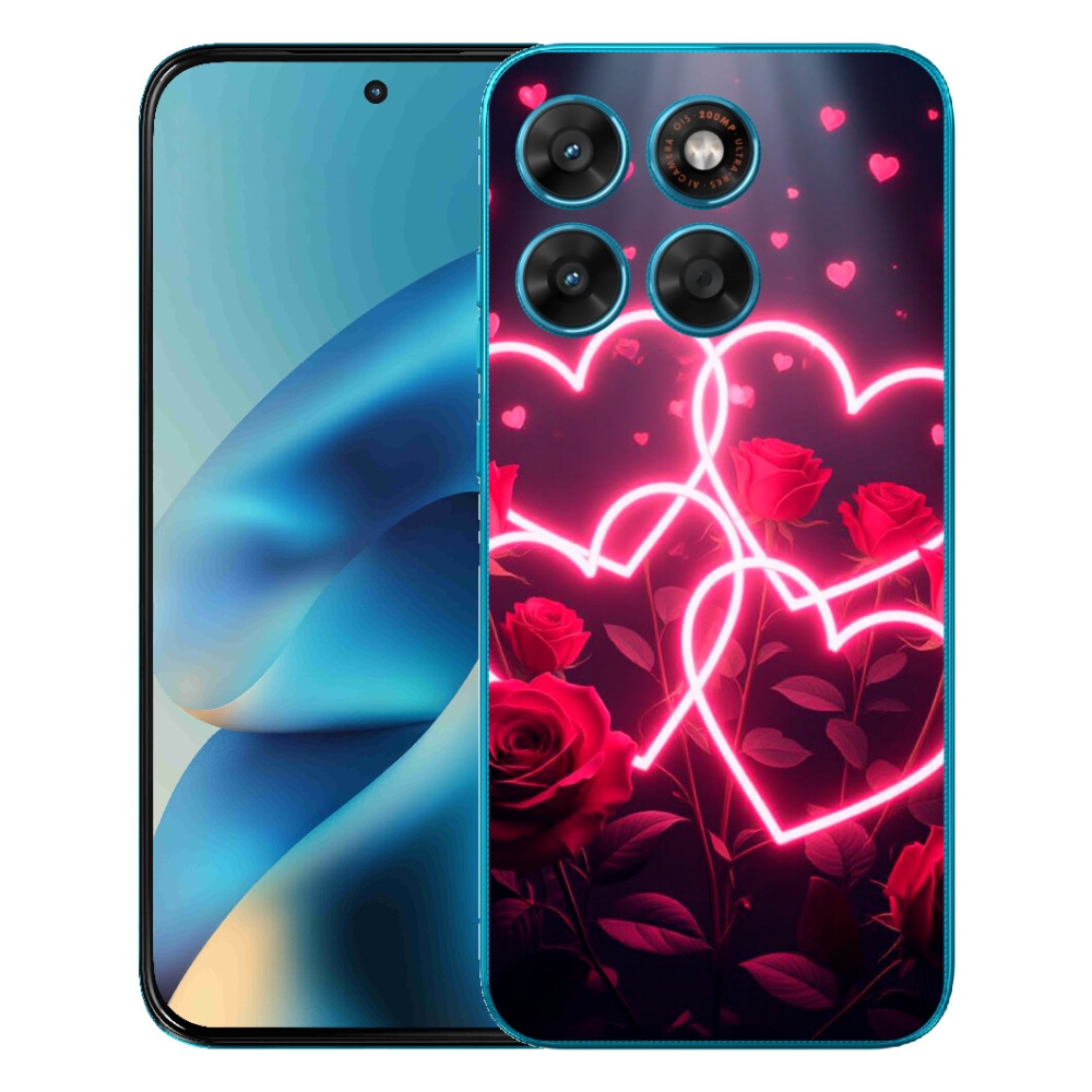 mmCase géltok a Motorola Moto G87/G77/G67 készülékekhez – a szerelem szíve
