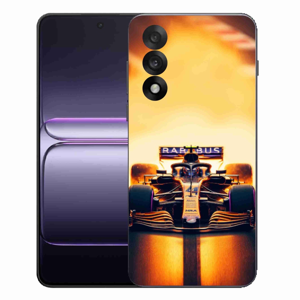 Gél borítás mmCase on One Plus Nord 5 - formula