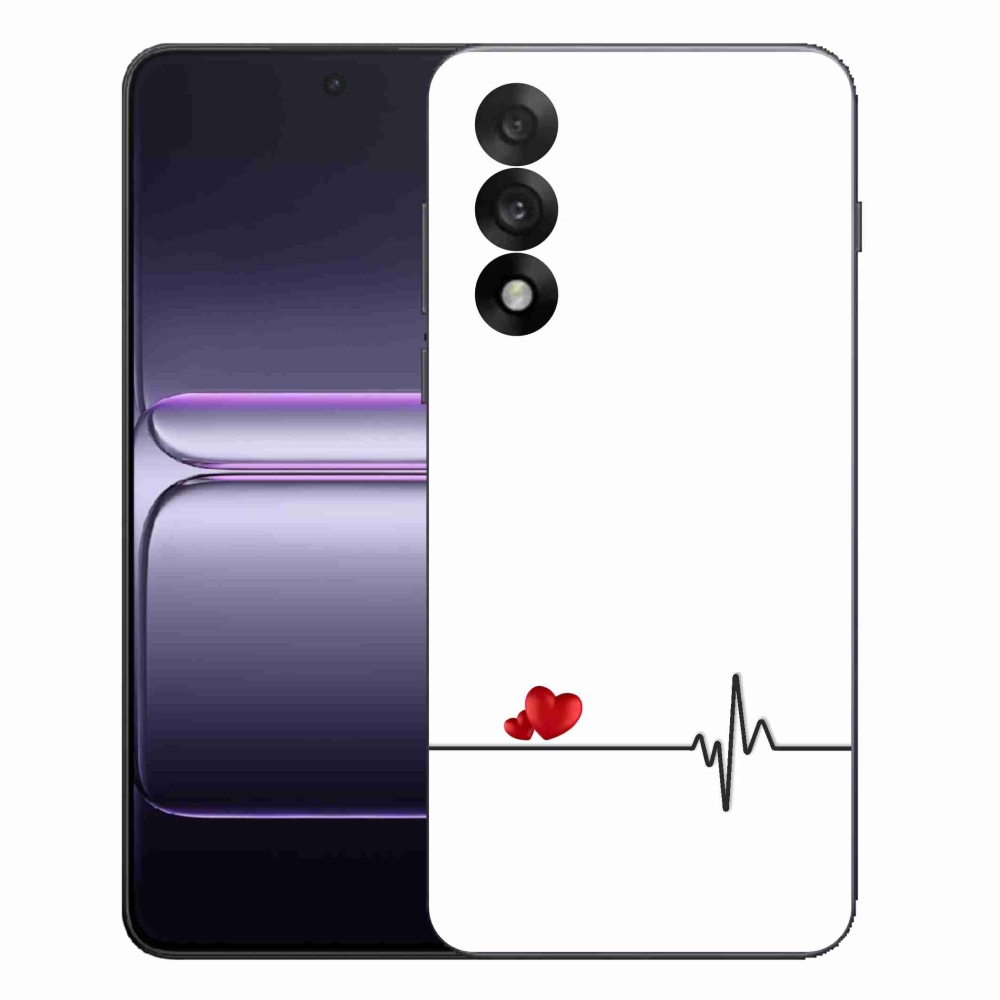 Gél borítás mmCase a One Plus Nord 5 készülékre - szív és szívverés fehér háttérrel