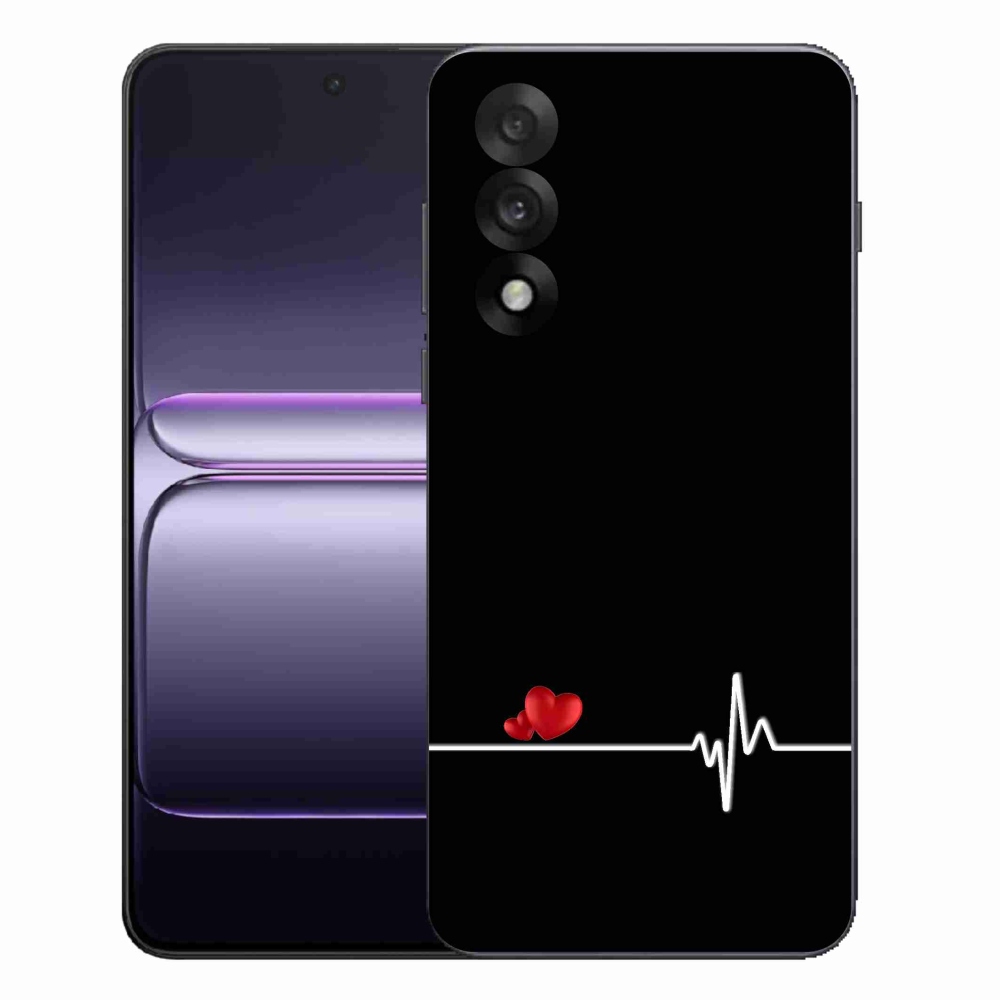 Gél borítás mmCase a One Plus Nord 5 készülékre - szív és szívverés fekete háttérrel