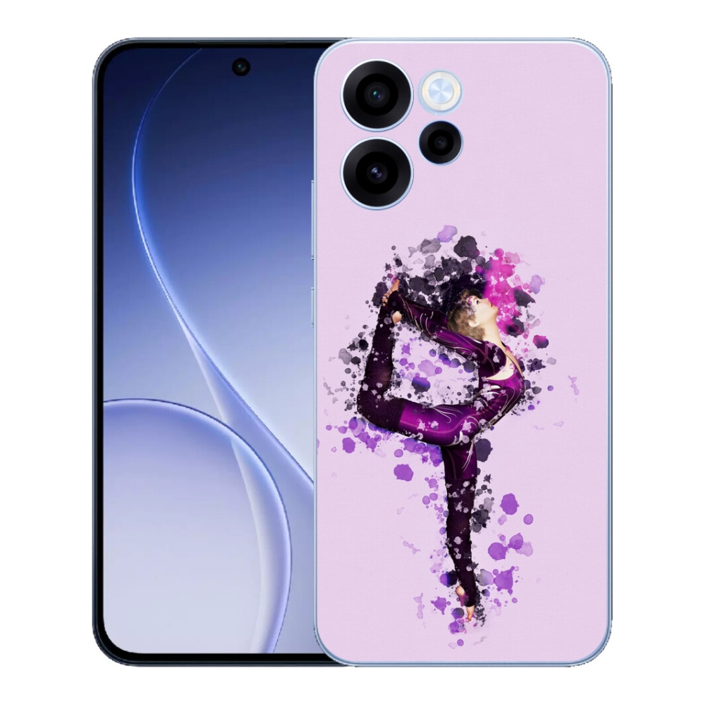 mmCase géltok az Oppo Reno 15 FS 5G-hez – balerina