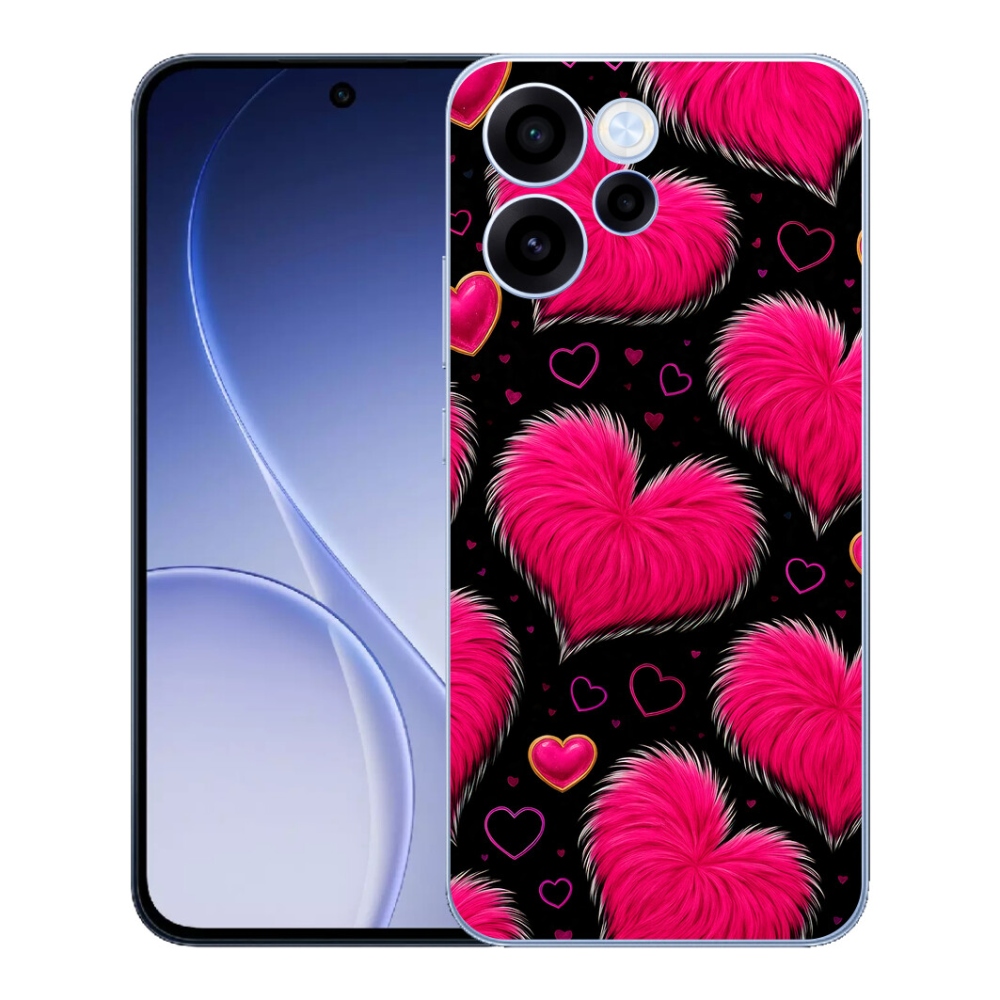 mmCase géltok az Oppo Reno 15 FS 5G-hez – puha szívek